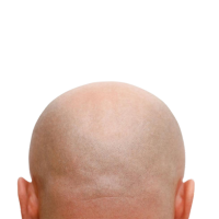 HAIRLESS