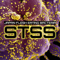 JAPAN FLESH EATING BACTERIA STSS